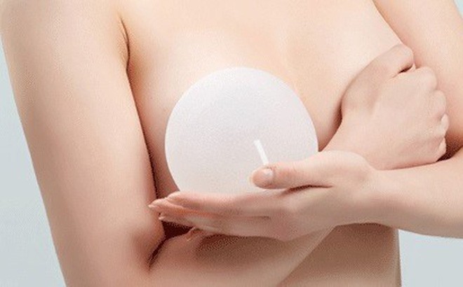 Ngực nữ doanh nhân Việt 33 tuổi sưng to như muốn nổ tung sau thẩm mĩ  - Ảnh 2.