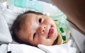 Khối u 'khổng lồ' che lấp miệng một cô bé 9 tháng tuổi