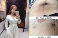 7 bước làm đẹp sau sinh để thoát khỏi cảnh ‘bụng bèo nhèo mỡ, rạn da, sạm đen’