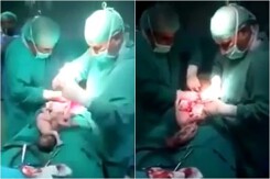 Video sinh mổ khiến bác sĩ ‘nín thở’ đếm số thai nhi gây bão mạng xã hội