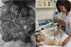 Bé trai thủng ruột vì nhiễm ấu trùng giun từ chó mèo: Dân mạng tranh cãi 'có nên nuôi chó mèo không'