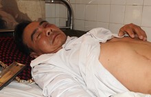 Một thương binh hạng 2/4 bị nhóm thanh niên chặn xe, hành hung