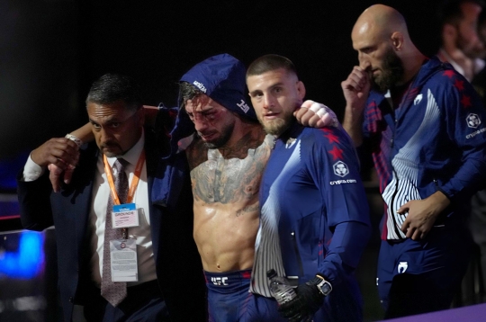 Pimblett: Topuria khó trở lại như xưa sau trận thua Gaethje
